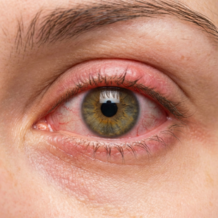 Inflammatory Response Reduction